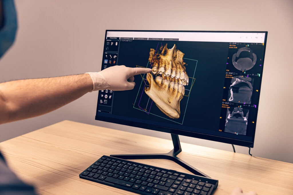3D dental radiography image from cone beam tomography, a sophisticated diagnostic tool used at Princeton Prosthodontics.